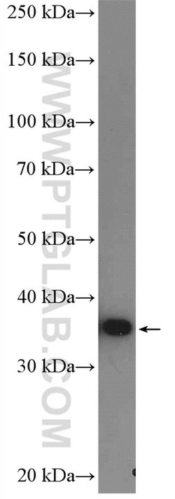 AMPK beta 1 Rabbit anti-Human, Mouse, Polyclonal, Proteintech 150 &mu;L;