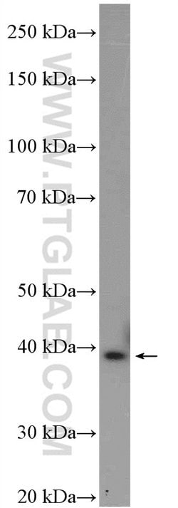 AMPK beta 1 Rabbit anti-Human, Mouse, Polyclonal, Proteintech 150 &mu;L;
