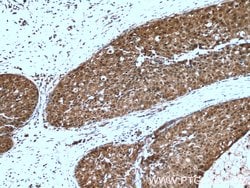 PSMD9 Rabbit anti-Human, Mouse, Polyclonal, Proteintech:Antibodies:Primary