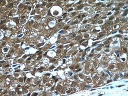PSMD9 Rabbit anti-Human, Mouse, Polyclonal, Proteintech:Antibodies:Primary