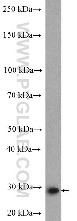 PSMD9 Rabbit anti-Human, Mouse, Polyclonal, Proteintech:Antibodies:Primary