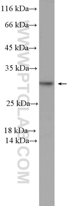 PSMD9 Rabbit anti-Human, Mouse, Polyclonal, Proteintech:Antibodies:Primary