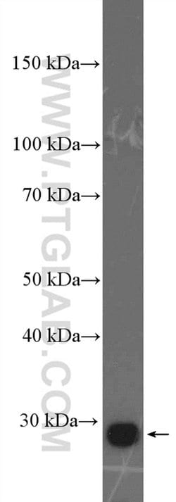 PSMD9 Rabbit anti-Human, Mouse, Polyclonal, Proteintech:Antibodies:Primary