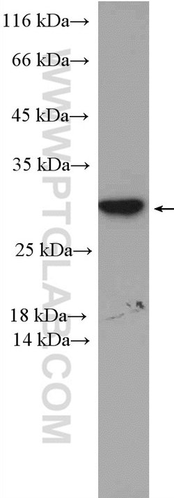 PSMD9 Rabbit anti-Human, Mouse, Polyclonal, Proteintech:Antibodies:Primary