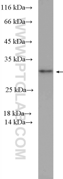PSMD9 Rabbit anti-Human, Mouse, Polyclonal, Proteintech:Antibodies:Primary