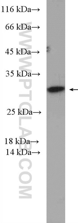 PSMD9 Rabbit anti-Human, Mouse, Polyclonal, Proteintech:Antibodies:Primary