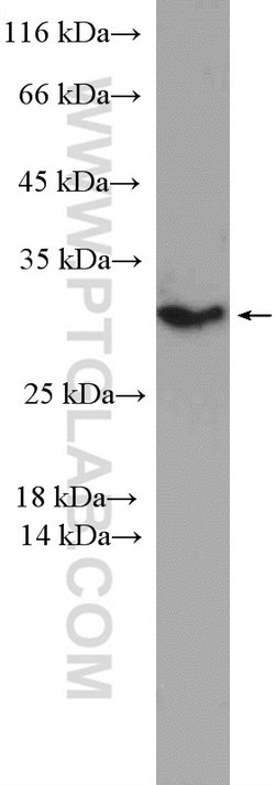 PSMD9 Rabbit anti-Human, Mouse, Polyclonal, Proteintech:Antibodies:Primary