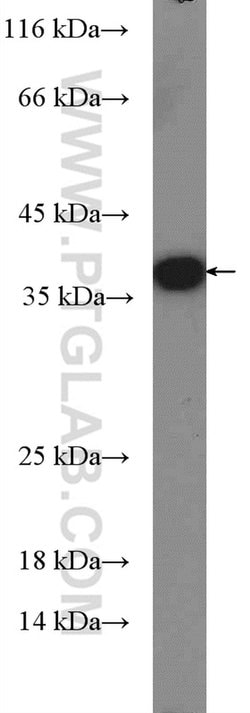 Sa Cas9 Rabbit anti-Bacteria, Polyclonal, Proteintech
