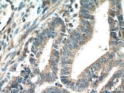 ADAM12 Rabbit anti-Human, Mouse, Rat, Polyclonal, Proteintech 150 &mu;L;