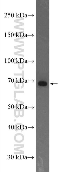 ADAM12 Rabbit anti-Human, Mouse, Rat, Polyclonal, Proteintech 150 &mu;L;