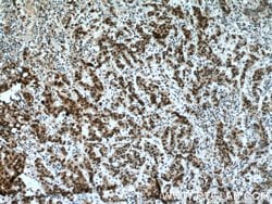 USP7 Rabbit anti-Human, Mouse, Polyclonal, Proteintech:Antibodies:Primary