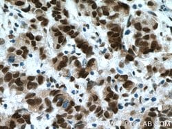 USP7 Rabbit anti-Human, Mouse, Polyclonal, Proteintech:Antibodies:Primary
