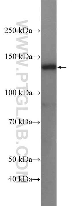 USP7 Rabbit anti-Human, Mouse, Polyclonal, Proteintech:Antibodies:Primary