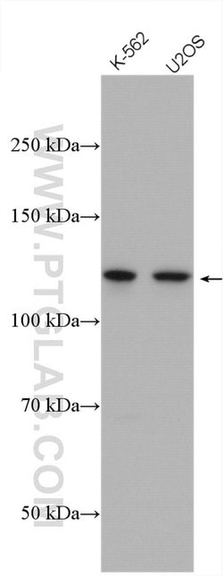 USP7 Rabbit anti-Human, Mouse, Polyclonal, Proteintech:Antibodies:Primary
