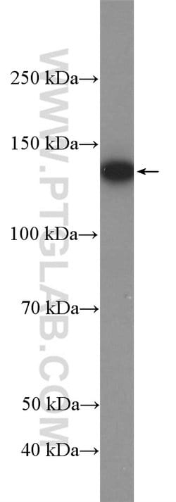 USP7 Rabbit anti-Human, Mouse, Polyclonal, Proteintech:Antibodies:Primary