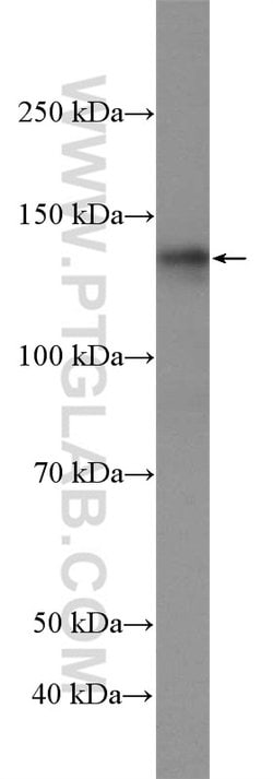 USP7 Rabbit anti-Human, Mouse, Polyclonal, Proteintech:Antibodies:Primary
