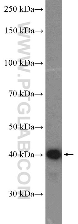 FCRLA Rabbit anti-Human, Polyclonal, Proteintech:  