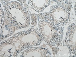GnRH Rabbit anti-Human, Polyclonal, Proteintech 150 &mu;L; Unconjugated:Antibodies,