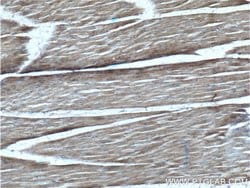 RYR1 Rabbit anti-Human, Mouse, Polyclonal, Proteintech:Antibodies:Primary