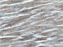 RYR1 Rabbit anti-Human, Mouse, Polyclonal, Proteintech:Antibodies:Primary