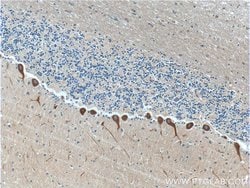 RYR1 Rabbit anti-Human, Mouse, Polyclonal, Proteintech:Antibodies:Primary