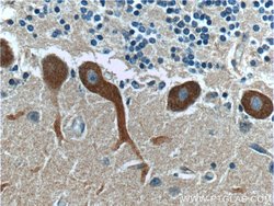 RYR1 Rabbit anti-Human, Mouse, Polyclonal, Proteintech:Antibodies:Primary