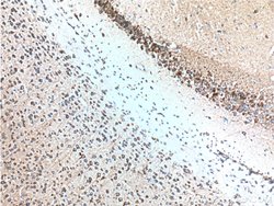 RYR1 Rabbit anti-Human, Mouse, Polyclonal, Proteintech:Antibodies:Primary