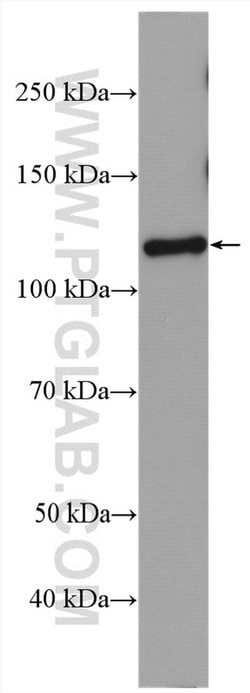PAM Rabbit anti-Human, Polyclonal, Proteintech 150 &mu;L; Unconjugated:Antibodies,