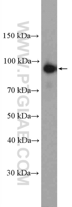 Calpain 7 Rabbit anti-Human, Mouse, Polyclonal, Proteintech:Antibodies:Primary