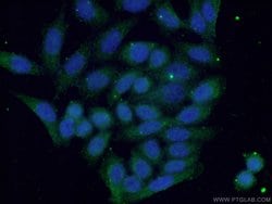 S100A9 Rabbit anti-Human, Polyclonal, Proteintech:Antibodies:Primary Antibodies
