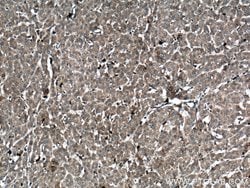 S100A9 Rabbit anti-Human, Polyclonal, Proteintech:Antibodies:Primary Antibodies