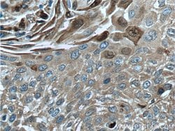 S100A9 Rabbit anti-Human, Polyclonal, Proteintech:Antibodies:Primary Antibodies