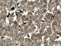 S100A9 Rabbit anti-Human, Polyclonal, Proteintech:Antibodies:Primary Antibodies
