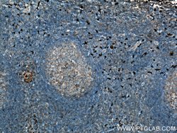 S100A9 Rabbit anti-Human, Polyclonal, Proteintech:Antibodies:Primary Antibodies