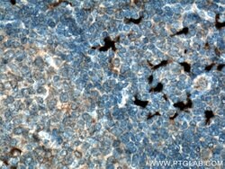 S100A9 Rabbit anti-Human, Polyclonal, Proteintech:Antibodies:Primary Antibodies