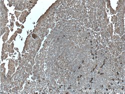 S100A9 Rabbit anti-Human, Polyclonal, Proteintech:Antibodies:Primary Antibodies