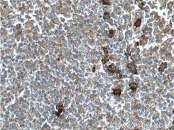 S100A9 Rabbit anti-Human, Polyclonal, Proteintech:Antibodies:Primary Antibodies