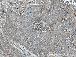 S100A9 Rabbit anti-Human, Polyclonal, Proteintech:Antibodies:Primary Antibodies