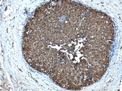 S100A9 Rabbit anti-Human, Polyclonal, Proteintech:Antibodies:Primary Antibodies