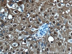 S100A9 Rabbit anti-Human, Polyclonal, Proteintech:Antibodies:Primary Antibodies