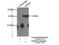 S100A9 Rabbit anti-Human, Polyclonal, Proteintech:Antibodies:Primary Antibodies
