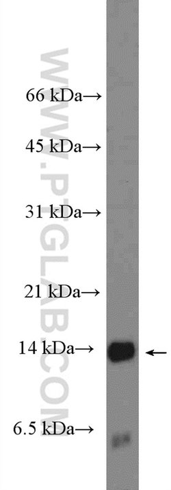 S100A9 Rabbit anti-Human, Polyclonal, Proteintech:Antibodies:Primary Antibodies