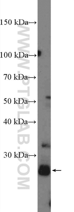 CITED1 Rabbit anti-Human, Rat, Polyclonal, Proteintech 150 &mu;L; Unconjugated:Antibodies,