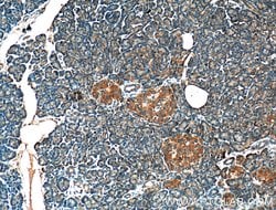 CRELD2 Rabbit anti-Human, Polyclonal, Proteintech 150 &mu;L; Unconjugated:Antibodies,
