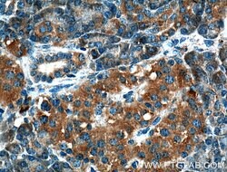 CRELD2 Rabbit anti-Human, Polyclonal, Proteintech 150 &mu;L; Unconjugated:Antibodies,