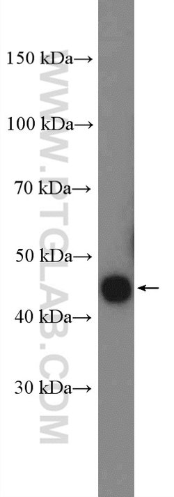 CRELD2 Rabbit anti-Human, Polyclonal, Proteintech 150 &mu;L; Unconjugated:Antibodies,