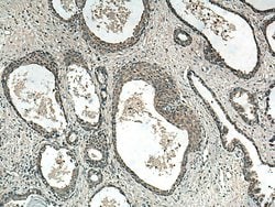 RNF113A Rabbit anti-Human, Polyclonal, ProteinTech 150 &mu;L; Unconjugated:Antibodies,