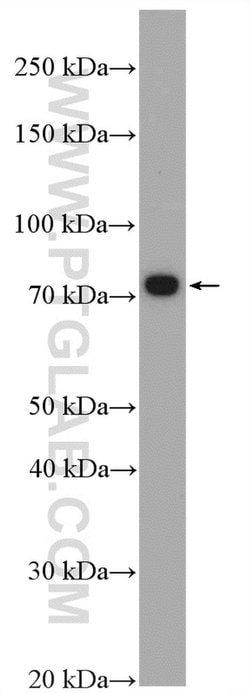 C9orf102 Rabbit anti-Human, Polyclonal, Proteintech:Antibodies:Primary