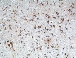 FIBIN Rabbit anti-Human, Polyclonal, Proteintech:Antibodies:Primary Antibodies
