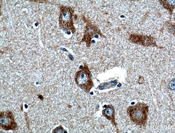 FIBIN Rabbit anti-Human, Polyclonal, Proteintech:Antibodies:Primary Antibodies